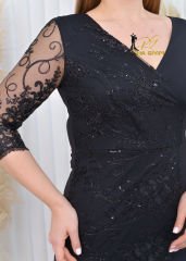 Kolları Dantel Model Kısa Elbise -Siyah
